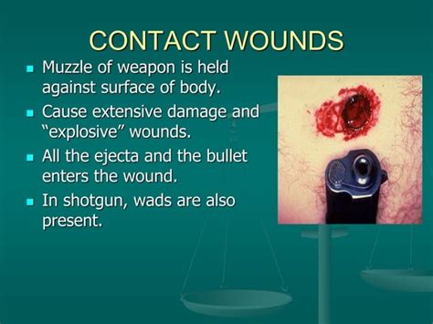 Classification Of Gunshot Wounds Ppt