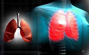 Mexican research proposes alternative therapy against lung cancer Lung Cancer  