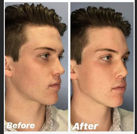 5 Tips For Improving Your Jawline Justinboey