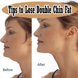 Another way on how to lose face fat fast is to eat greek yogurts. 18 Easy Ways to Get Rid Of Double Chin Fast at Home | Double chin, Style and Self confidence