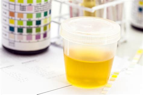 What Blood In Your Urine Can Mean Elite Hospital Kingwood