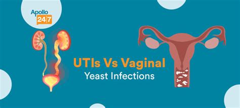 Utis Vs Vaginal Yeast Infection Whats The Difference And How To