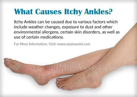 What Causes Itchy Ankles Itching Skin Itchy Itchy Skin