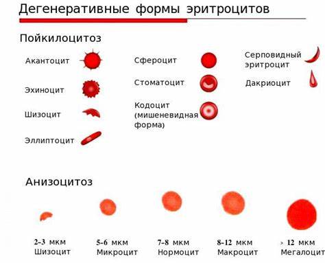 Диета при железодефицитная анемия жда 1 степени что это такое у женщин жда 1 степени что это такое у женщин Диета при железодефицитная анемия