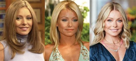 Kelly Ripa Plastic Surgery Before And After Pictures 2022