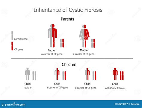 Cystic Fibrosis Mucoviscidosis Inheritance Stock Illustration