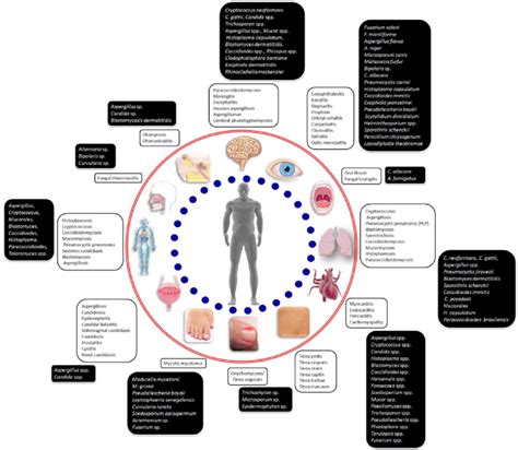 Spectrum Of Fungal Infections And Their Etiological Agents In Humans