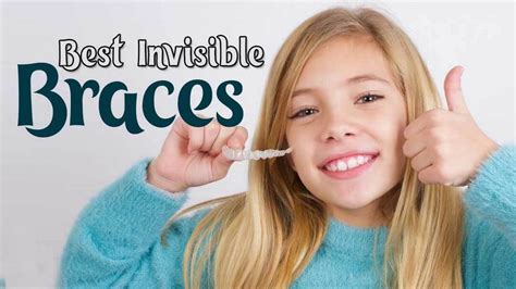 The Best Invisible Braces In 2023 Brighten Your Smile With Top Brands Raleigh News And Observer