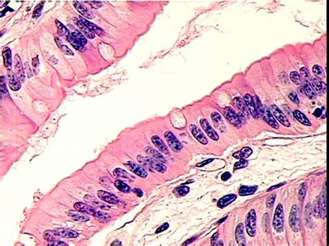 Histology Small Intestine Surface Epithelium Of Simple Columnar And
