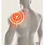 Shoulder Rotator Cuff Injuries Treatment Stem Cell Therapy Brooklyn 