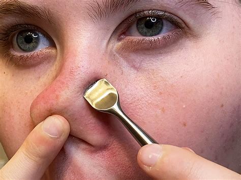 Popping A Pimple In The Triangle Of Death Could Lead To Infection