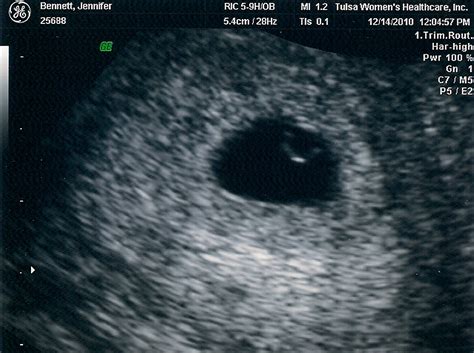 Baby developing inside you over the weeks and months. The Bennett Life: First Ultrasound