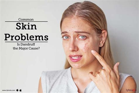 Common Skin Problems Is Dandruff The Major Cause By Dr Ashima