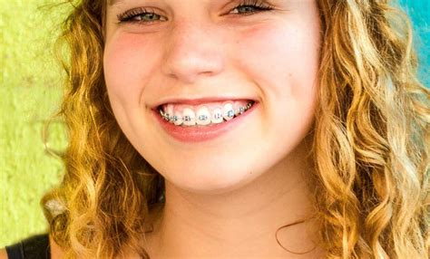 girl with braces telegraph