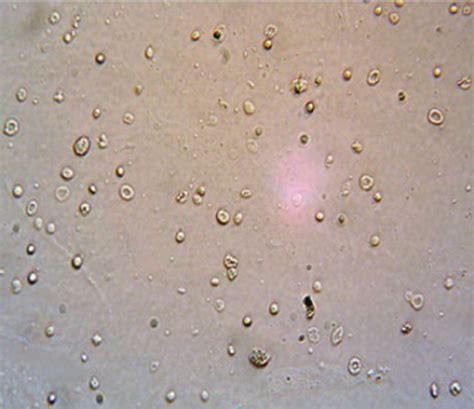 Rbc Cell In Urine