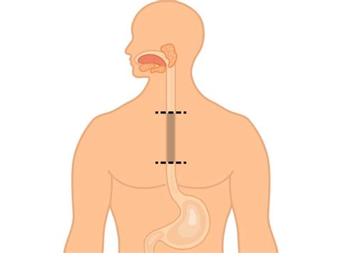 Less Invasive Surgery Wins In Esophageal Cancer MedPage Today