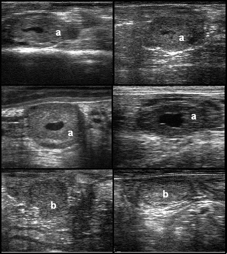 Imagens ultrassonográficas de corpos lúteos das receptoras Corpo lúteo