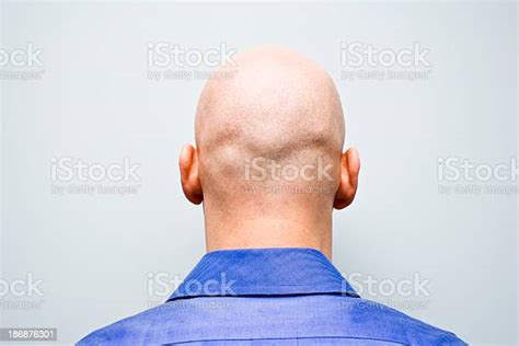 Back Of Man Ist Bald Head Stockfoto Und Mehr Bilder Von Vollglatze Istock