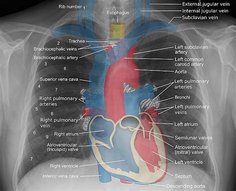 Image Mediastinal Structures On Chest X Ray Annotated