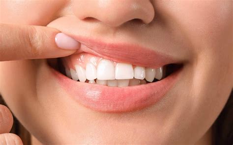 10 Tips For Keep Your Healthy Gums And Prevent Gum Disease