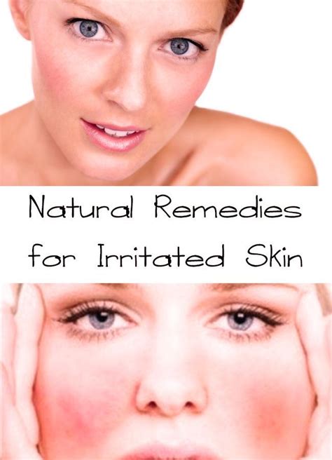 Irritated Skin Is So Annoying Are You Tired To Have Red And Irritated