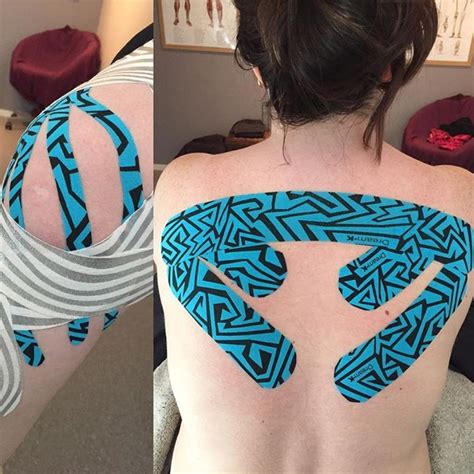 Using Kinesiology Tape To Support Your Back And Remain Active While