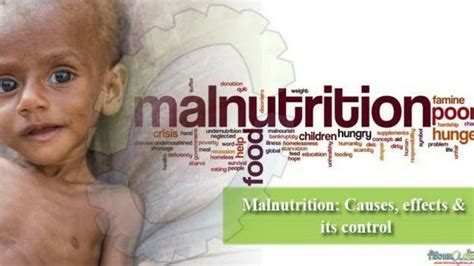Malnutrition Types And Classification Symptoms And Treatment Youtube