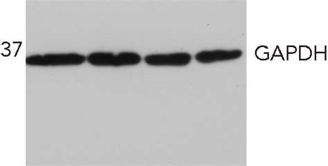 Western Blotting Gapdh Antibody From Abcam Biocompare Antibody Review