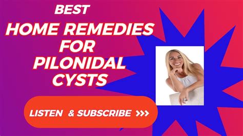 Best Home Remedies For Pilonidal Cysts Youtube