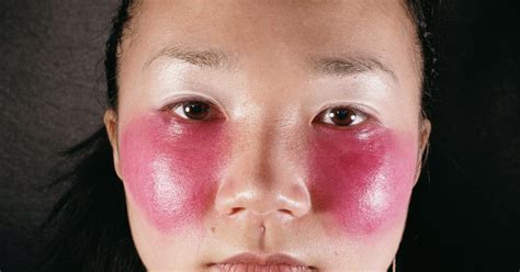 Red Cheeks In Kids During Cold Weather Ehow Uk