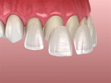 Noticias Archivos Daldent Dentistas De Implantes Dentales