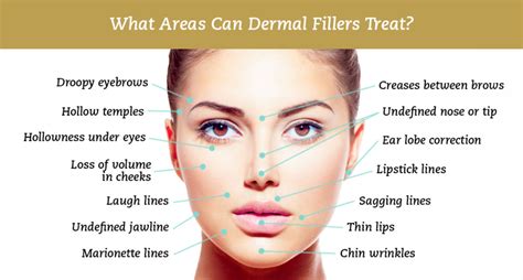 Dermal Fillers The Beauty Clinic 70 Pitt St Sydney