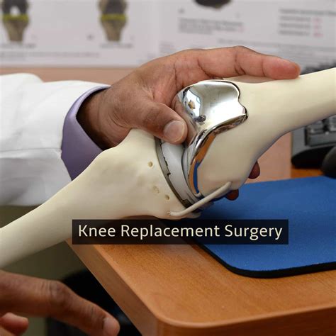 Types Of Knee Replacement Surgery