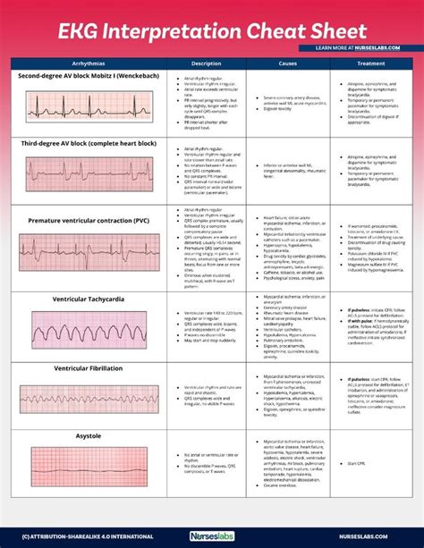 How To Read An Ecg Steps How To Do Thing