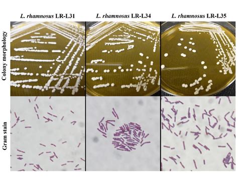 Colony Morphology And Gram Stains Of L Rhamnosus Strains L31 L34 And