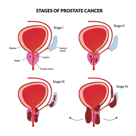 Anatomia De La Prostata Ppt Vrogue Co
