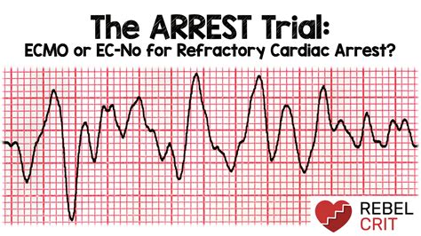 The Arrest Trial Ecmo Or Ec No For Refractory Cardiac Arrest Rebel