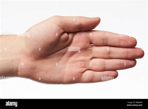 One Rough Palm Hand With Blister Isolated On White Background Stock