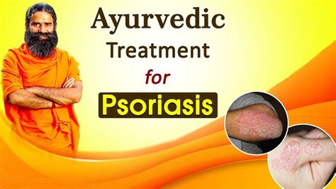 Ayurvedic Treatment For Psoriasis Swami Ramdev Youtube