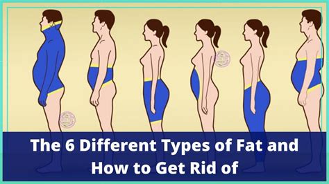 The 6 Different Body Fat Types And How To Get Rid Of Them Youtube
