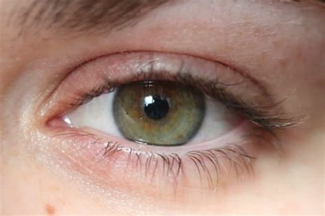 What Is The Rarest Eye Color In The World Skin Care Geeks