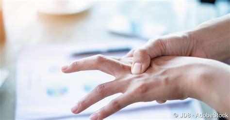Fingerluxation Erste Hilfe Prognose Behandlung Netdoktorde