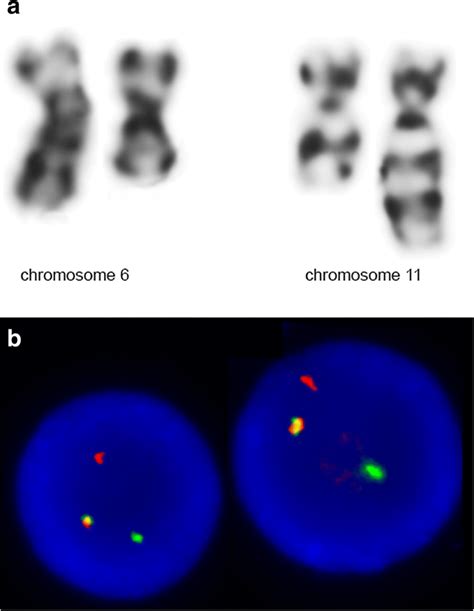 A Giemsa Stained Chromosome Pairs 6 And 11 B Interphase Fish Nuclei Of