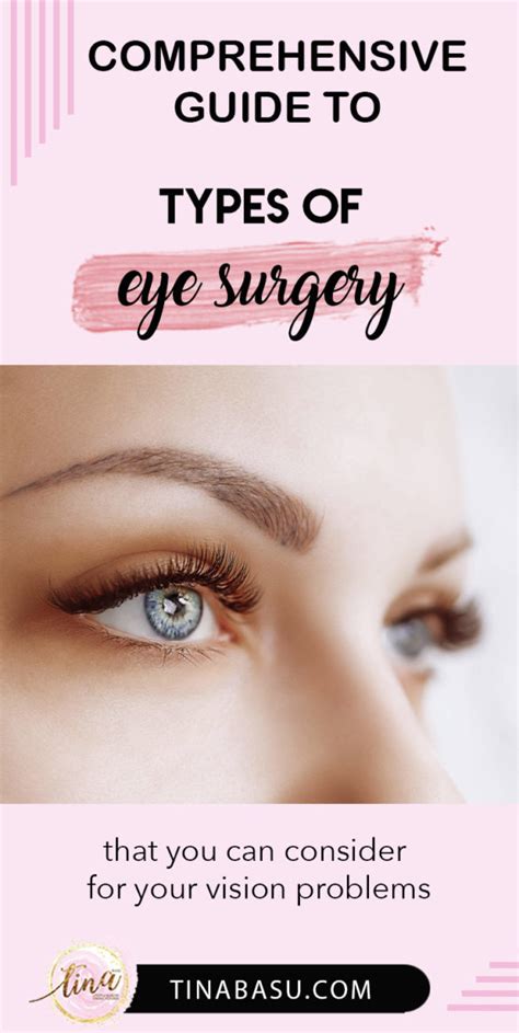 Guide To Types Of Eye Surgery Tina Basu Lifestyle Blog