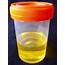 Wellness Lab Health Info What Does The Colour Of Your Urine Says About 