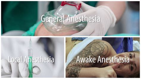 Three Types Of Anesthesia Used In Plastic Surgery Youtube