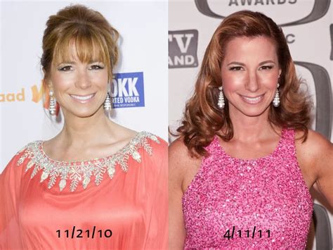 jill zarin breast reduction surgeon increase breast size naturally before and after que