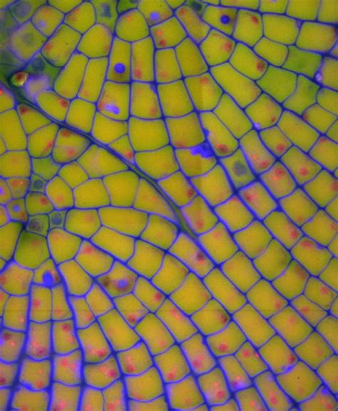 Animal cells also have a because only plant cells perform photosynthesis, chloroplasts are found only in plant cells. Plant cells under a microscope : Biological Science ...