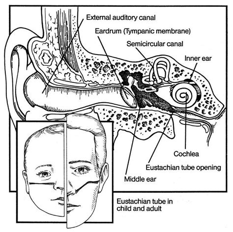 Ear Infections — Why Are They So Common In Kids Salem Pediatric Clinic