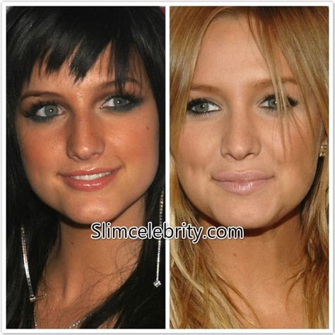 Pin By Lisa Smith On Ashlee Simpson Plastic Surgery Before And After Plastic Surgery Nose Job
